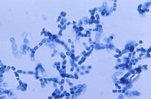 Ph. Ascomycota Coccidioides immitis Cause of valley fever when conidia inhaled Infection may spread to skin, bones,