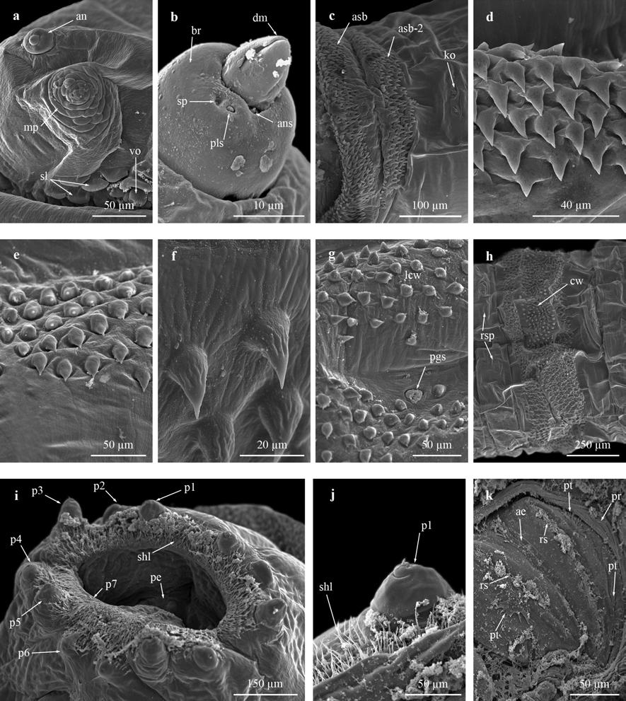 Fig. S5 Selected morphological features of the second instar larva of S. (L.) tibialis by SEM. a Detail of cephalic lobe. b Detail of antenna. c Ventral view of anterior spinose band of ti.