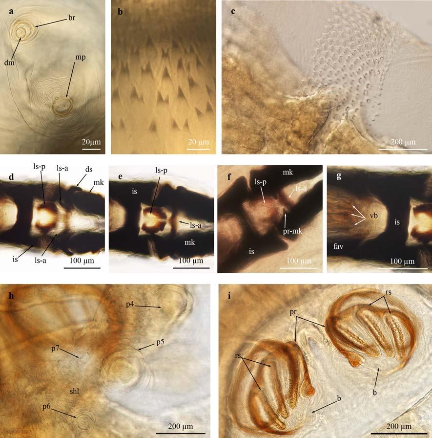 Fig. S6 Selected morphological features of the third instar larva of S. (L.) tibialis by light microscopy. a Detail of cephalic lobe. b Spines of ventral are of anterior spinose band of ti.