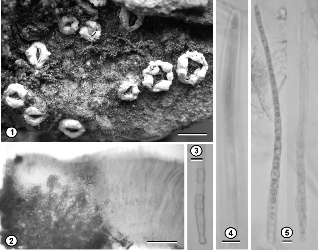 Chroodiscus... 249 Figure 1-5. Chroodiscus himalayanus (from holotype): 1. Habit; 2. L.S. of apothecia showing calcium oxalate crystals in exciple; 3. Bead like end cell; 4. Ascus; 5.