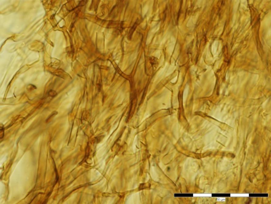 Figure 2 Phanerochaete thailandica. Vertical section of fruiting body with remarkable brown subiculum. Bar = 100 µm. Figure 3 Phanerochaete thailandica.