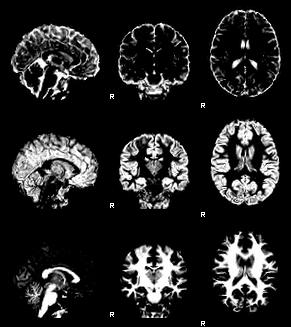 MR Images of Brain Anatomy