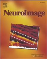 NeuroImage 51 (2010) 743 751 Contents lists available at ScienceDirect NeuroImage journal homepage: www.elsevier.