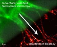 This is multi-modal imaging pushed beyond optical microscopy and to the nano scale Why TERS?