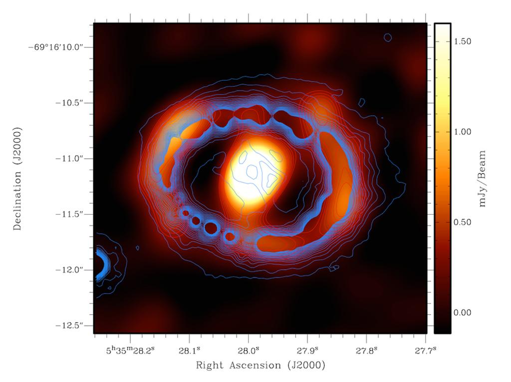 Dust in SN1987A SN shock-ring interaction Collisionally-heated