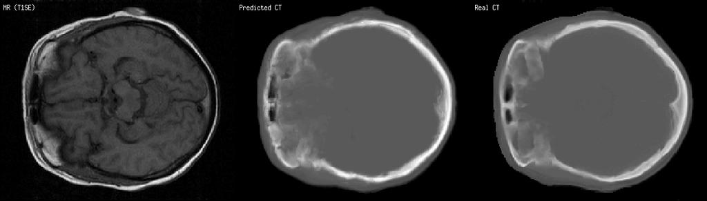 Many differences between b) and c) are due not to false classifications, but to some slight movement between MR and CT scans, which explains the misalignment between the test image a) and the ground