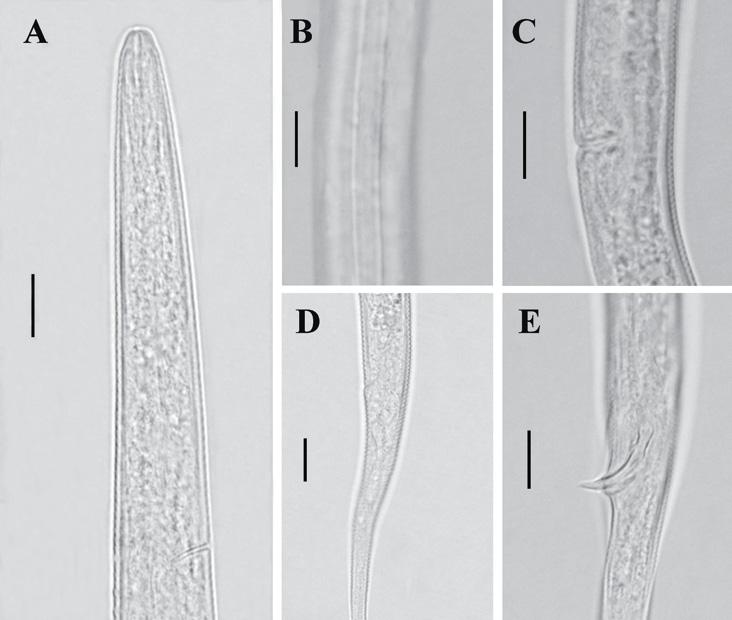 46 Azimi et al. Figure 2. Filenchus orientalis. A: Anterior region of female; B: Female lateral field at mid-body; C: Vulval region; D: Female tail; E: Male tail (Scale bars: 10 μm).