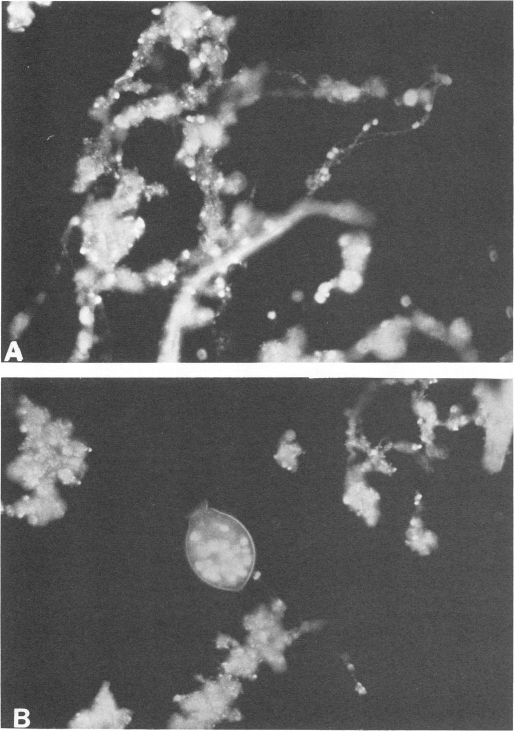 318 VAN DER DRIFT ET AL. APPL. ENVIRON. MICROBIOL. FIG. 3. Predation ofprotozoa on bacteria adsorbed on sludge flocs demonstrated by fluorescence photomicroscopy.