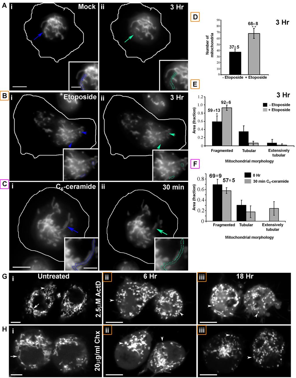 Sup. Fig 3 Mitochondria underwent fragmentation during genotoxic stress mediated cell