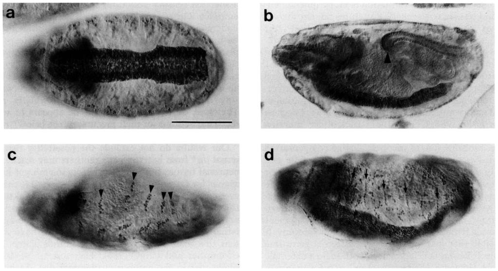 daugbterless role in neurogenesis Figure 5. Defects in female embryos from / mothers, [a] Ventral view of a 44C11-labeled 13-hr embryo from a cross between homozygous females and wild-type males.