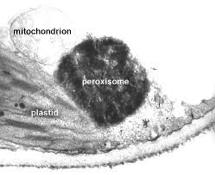 Peroxisomes Membrane Yes Description Spherical bags containing powerful digestive enzymes (Oxidases and peroxidases) Neutralize dangerous free radicals Oxidase converts them to H 2 O 2 (hydrogen