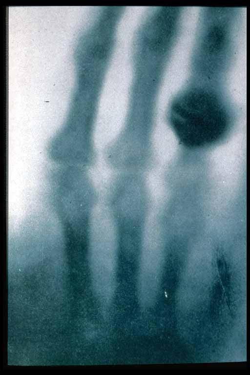 1901 for discovery of X-rays