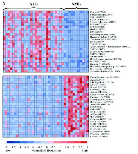 Transcript profiling in cancer Molecular classification of cancer types ALL acute lymphoblastic leukemia AML acute myeloid leukemia Transcriptome reflects Biology - Predictive - Treatment Transcript