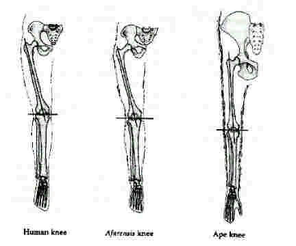 hip bone or pelvis) a strong, robust talus (ankle bone) a strong,