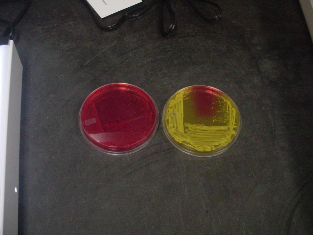 5% NaCl, mannitol, Phenol red ph indicator: alkaline ph = red/pink, acidic ph = yellow