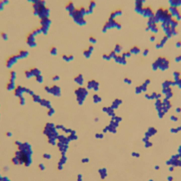1 2 5 6 9 2 7 10 Staphylococcus aureus 4