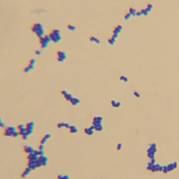 Staphylococcus epidermidis Klebsiella