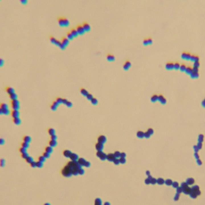 Enterococcus faecalis Streptococcus