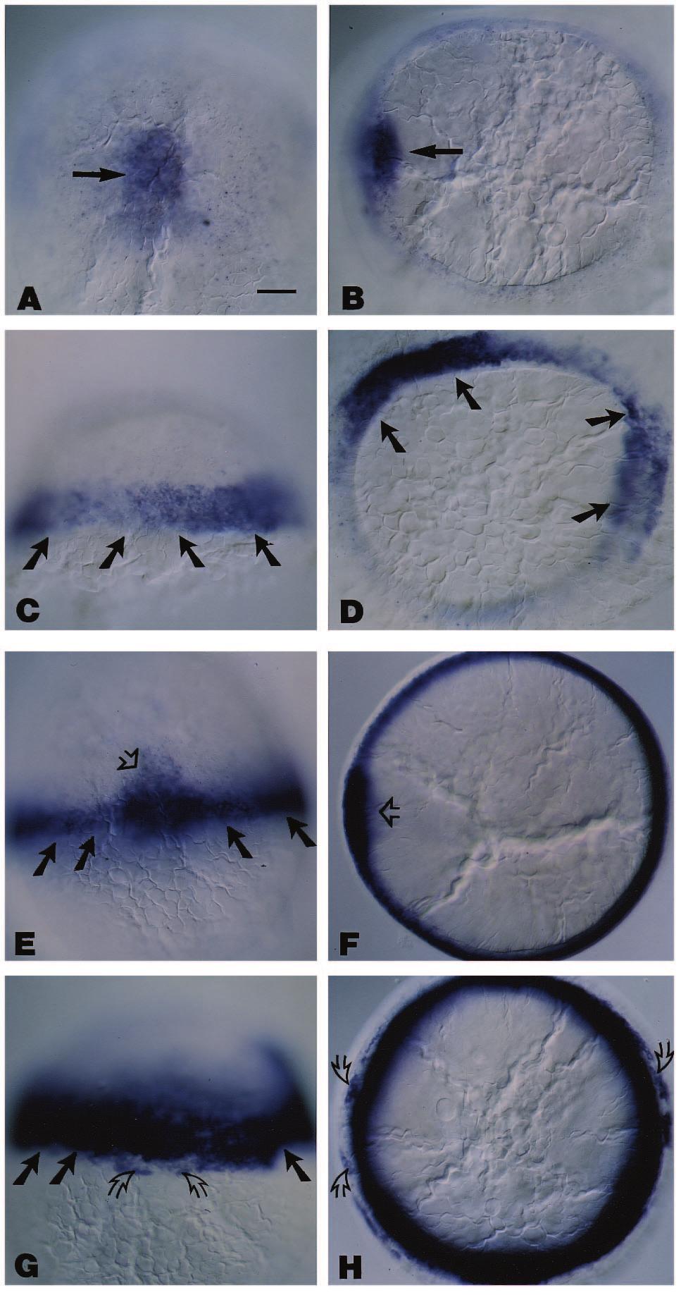 wnt8 and wnt8b expression in zebrafish embryos 1795 Fig. 7. The spatial localization of gsc and ntl transcripts in β-galactosidase-rna-injected and wnt8-rna-injected embryos at 55-60% epiboly.