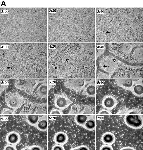 H.Ma et al. Fig. 6. Time-lapse video microscopy of wild-type and ddmek1 null cells.