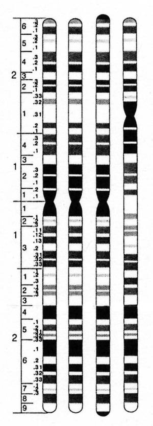 A fragment of aligned DNA sequences that codes for a protein common to each primate species and the chromosome banding patterns for the third chromosomes of each species are depicted below.