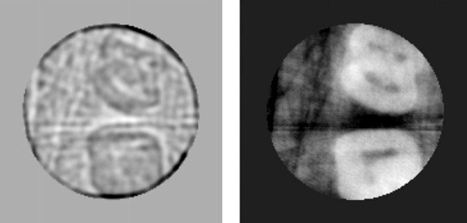 Local tomography results for dental X-ray imaging Λ-tomography MAP with B