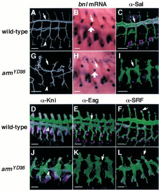 Wg regulates branching morphogenesis 4437 Fig. 3. Tracheal defects in zygotic arm mutants. Wild-type (A-F) or zygotic arm YD35 mutant (G-L) embryos.