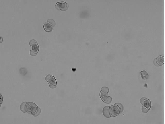 Be able to recognize the following structures: microsporophyll, microsporangia, and pollen (microspores). Microsporophyll 2.