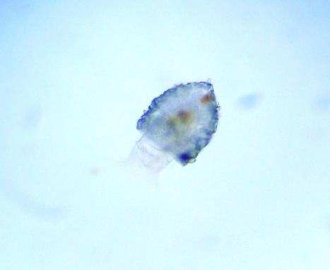 Diatoms common unicellar