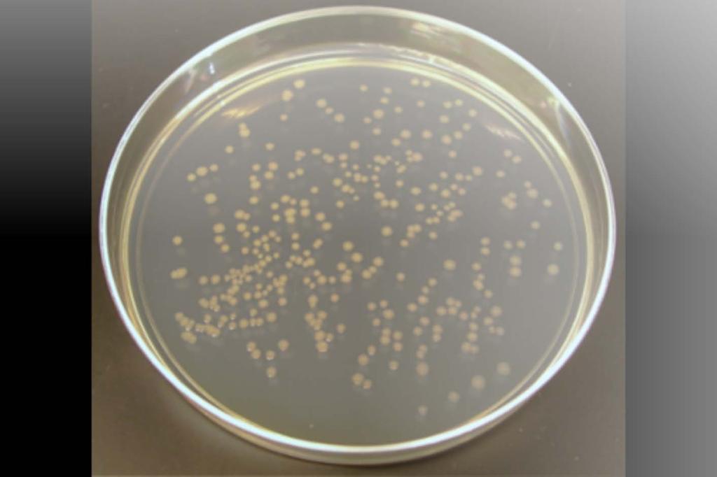 coli, most of the bacteria are killed, but a few resistant cells may survive and give rise to resistant colonies that can be seen on the surface of a petri