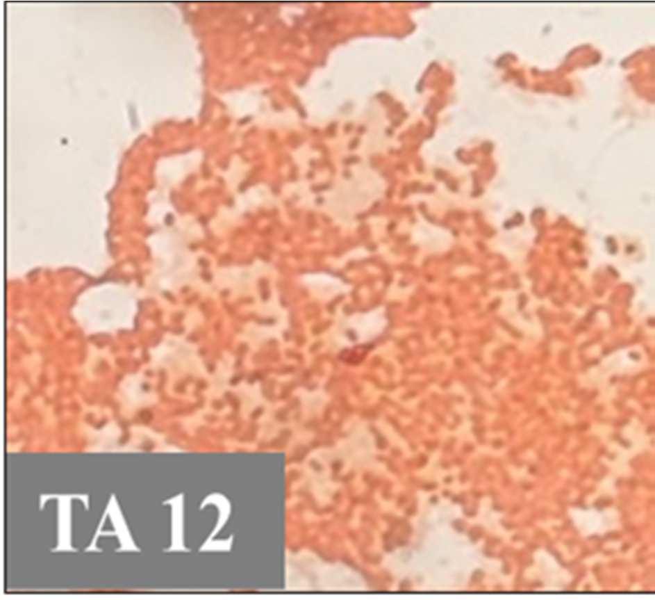 (TA14), Aeromonas (TA2 and TA5), Enterobacteriaceae (TA6 and TA12); and Gram positive coccus to genus Staphylococcus (TA17).