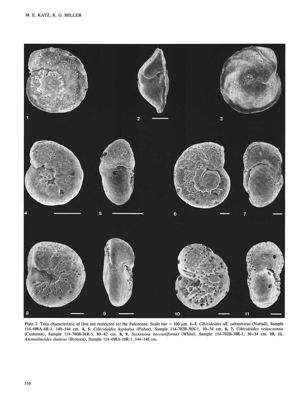M. E. KATZ, K. G. MILLER Plate 2. Taxa characteristic of (but not restricted to) the Paleocene. Scale bar = 100 µm. 1-3. Cibicidoides aff. subspiratus (Nuttall), Sample 114-698A-6R-1, 140-144 cm.