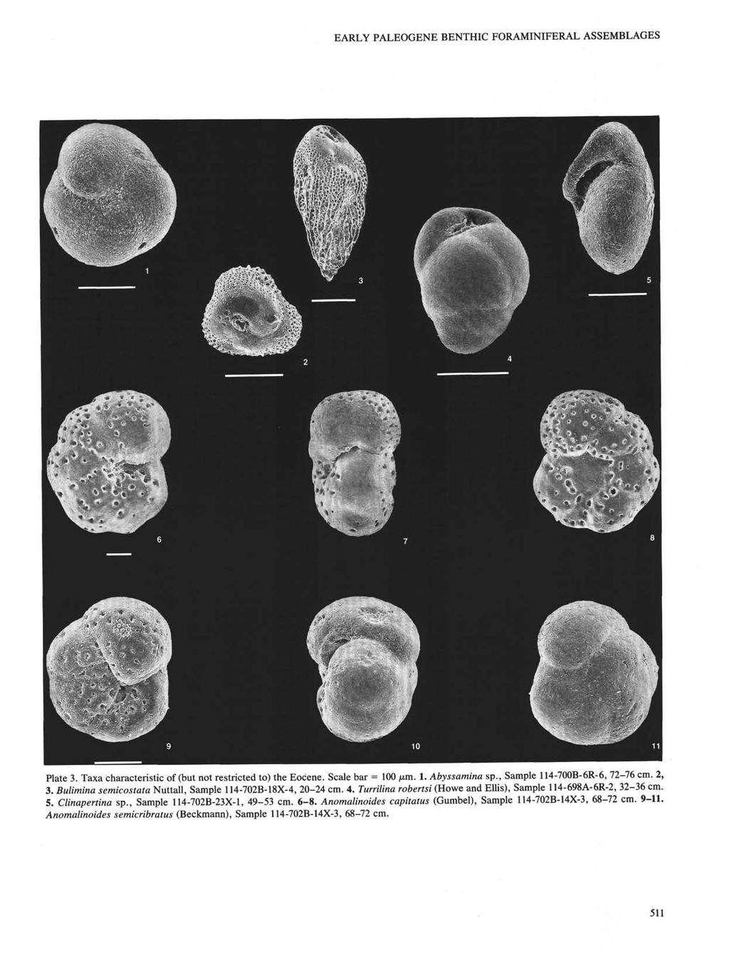 EARLY PALEOGENE BENTHIC FORAMINIFERAL ASSEMBLAGES Plate 3. Taxa characteristic of (but not restricted to) the Eocene. Scale bar = 100 µm. 1. Abyssamina sp., Sample 114-700B-6R-6, 72-76 cm. 2, 3.