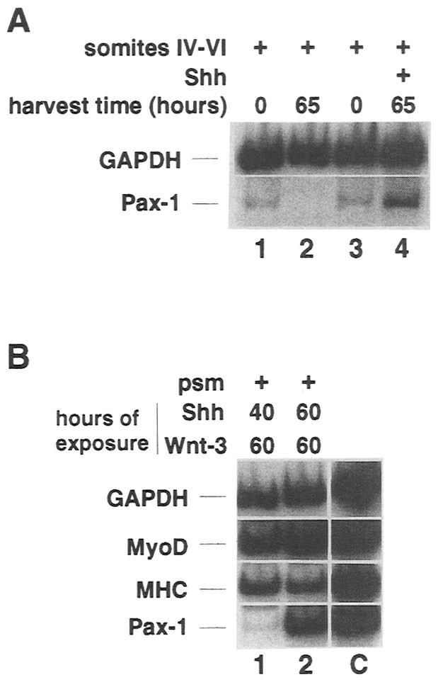 (A) Somites IV-VI were dissected from a stage 10 chick embryo and analyzed for the expression of GAPDH and Pax-1 either immediately following dissection (lanes 1,3), or after in vitro culture for 65