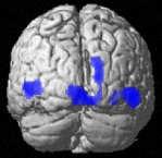 16 Friston & Kiebel incoherent stimuli in V1 and all other parts of the brain. Fig.