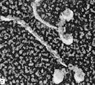 Myosin In Detail High-resolution electron micrograph