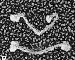 Kinesin In Detail High-resolution electron micrograph