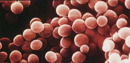 red blood cell lysis E.