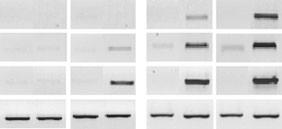 200 Diego Segond et al. Figure 6. AtNRAMP3 expression in Arabidopsis mutants affected in the salicylic acid (SA), jasmonic acid (JA) and ethylene (ET) signaling pathways.