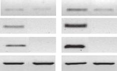 with that of the wild-type ecotype Ws during infection. Northern blot analysis showed that the upregulation of AtFER1 expression was reduced in the nramp3 nramp4 mutant (Figure 9a).