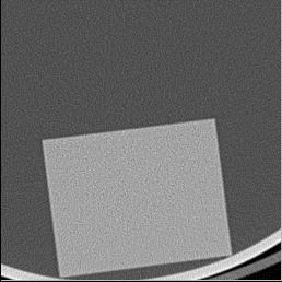 100 50 smooth image CT w 10 Position