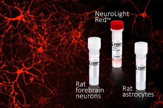 Neuron specific live-cell labeling reagents and cell kits analyze neurite dynamics in co-cultures NeuroLight Red lentivirus reagent for efficient labeling of neurons without perturbing the underlying