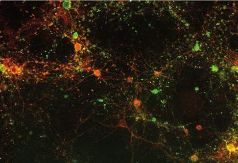 Annexin V Green reagent Rat forebrain neurons in culture with astrocytes. 300 µm glutamate (left) vs. control (right), 5 hours after treatment.