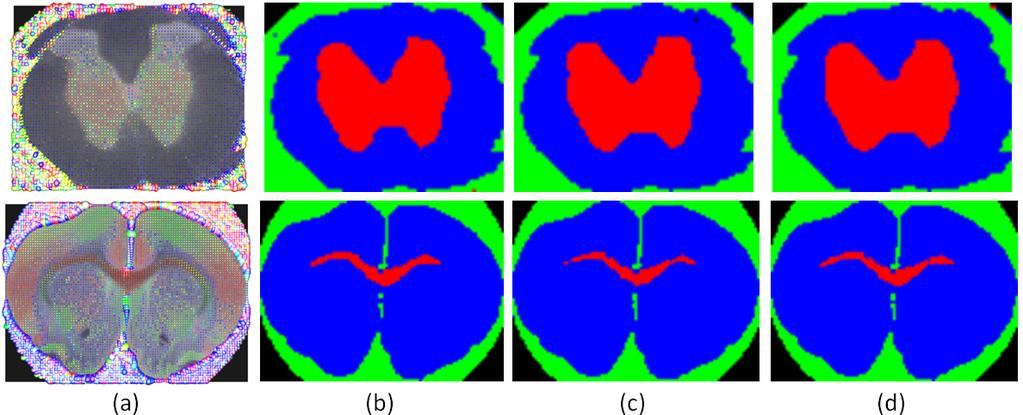 The results confirm that the DTI segmentation methods based on convex relaxation do provide robust and accurate segmentation results on real diffusion tensor images. Fig. 5.