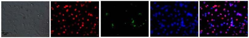 Confocal fluorescence images of MDA-MB231 cells under various conditions were presented in Figure S4.1. The multiple red and green spots on Figure S4.