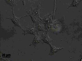 Confocal fluorescence microscope images of HEK293 cells upon treatment with A) ZG-01 (FA+VE) NPs (0.