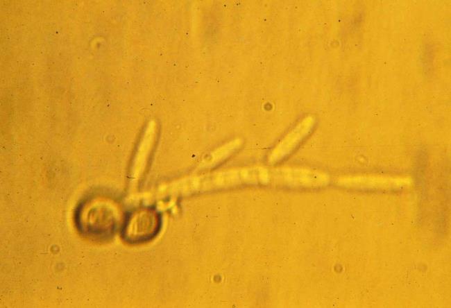 basidiospores (n) Two