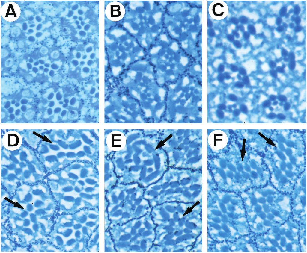 Note that in panels B, E, G and H the presence of supernumerary R7 cells is suppressed and thus many ommatidia have wild-type appearance (indicated with arrowheads), but that the R7 to R1-6