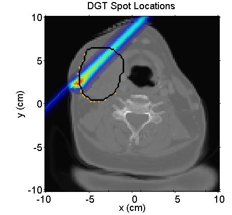 Spot Scanning and DET SS Spot Locations (~300) DET Spot Locations (~20) Distal Edge of Target - For DET