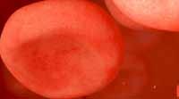 Stem cells can divide to form the cells of an organism or differentiate into a specialized cell. microvilli 1 μm Erythrocytes are cells without a nucleus or mitochondria.